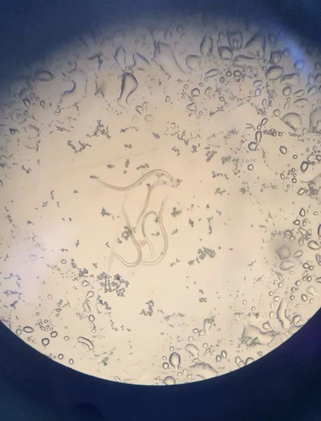 顯微鏡下觀察秀麗隱桿線蟲 顯微鏡下觀察秀麗隱桿線蟲