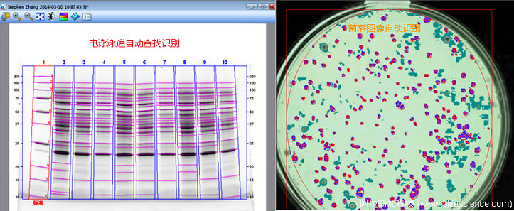 凝膠成像分析系統(tǒng)菌落計數(shù)的工作原理.jpg 凝膠成像分析系統(tǒng)菌落計數(shù)的工作原理.jpg